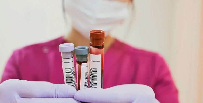 آزمایش CBC چیست و چه بیماریهایی را نشان میدهد؟ آزمایش CBC چیست و چه بیماریهایی را نشان میدهد؟