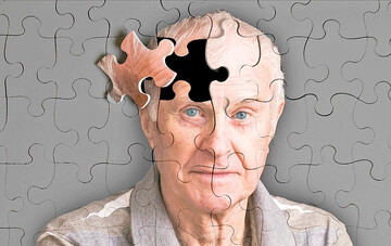 مردان بیشتر آلزایمر می‌گیرند