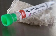 بررسی موارد مشکوک آبله میمونی در ۱۲ قطب دانشگاهی/درخواست خرید واکسن علیه این بیماری