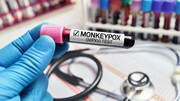 دولت بایدن آبله میمونی را یک وضعیت اضطراری بهداشت عمومی اعلام می کند؟