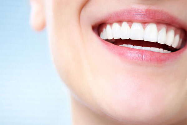 مراحل ایمپلنت دندان جلو چگونه است و چقدر طول میکشد؟