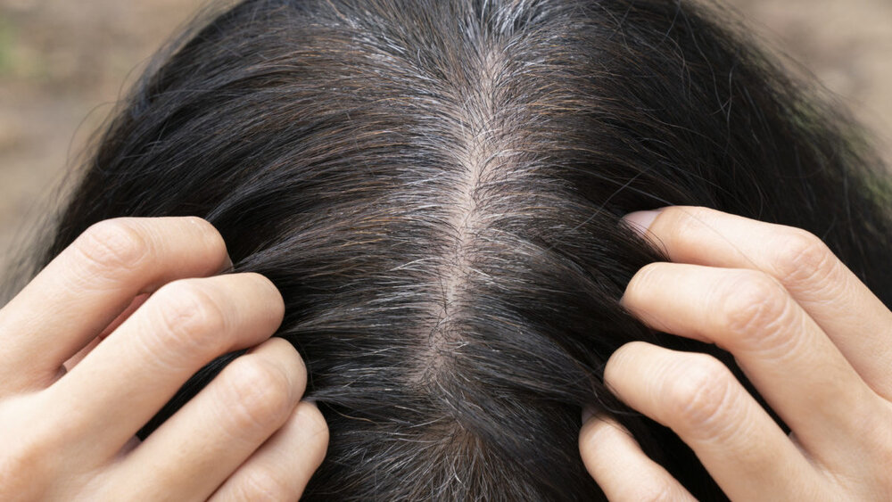 چرا نباید موهای سفید یا خاکستری را از ریشه بکنیم؟ چرا نباید موهای سفید یا خاکستری را از ریشه بکنیم؟