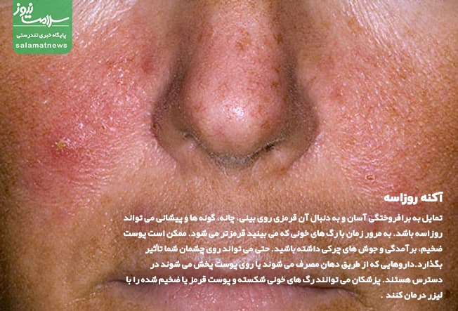 تصاویر انواع لکه های پوستی و روشهای درمان آنها