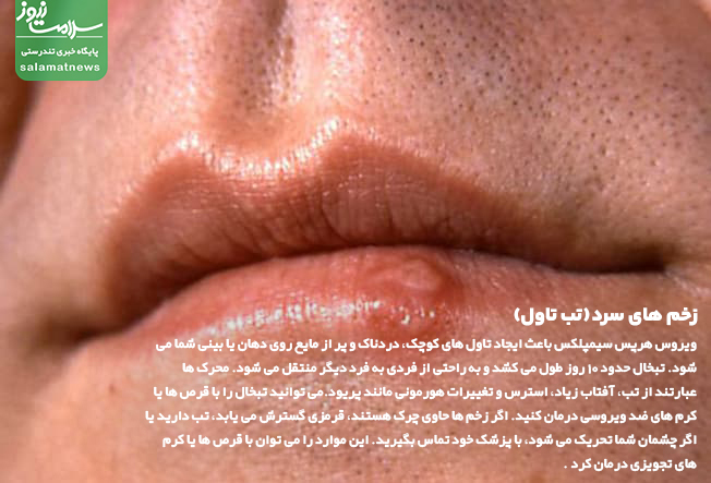تصاویر انواع لکه های پوستی و روشهای درمان آنها