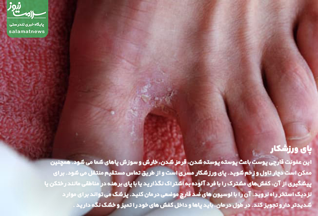 تصاویر انواع لکه های پوستی و روشهای درمان آنها