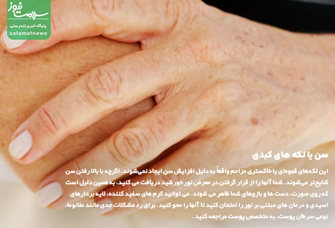 تصاویر انواع لکه های پوستی و روشهای درمان آنها