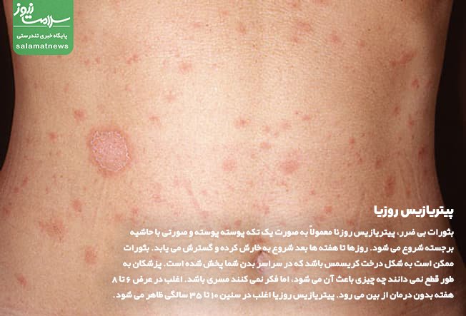 تصاویر انواع لکه های پوستی و روشهای درمان آنها