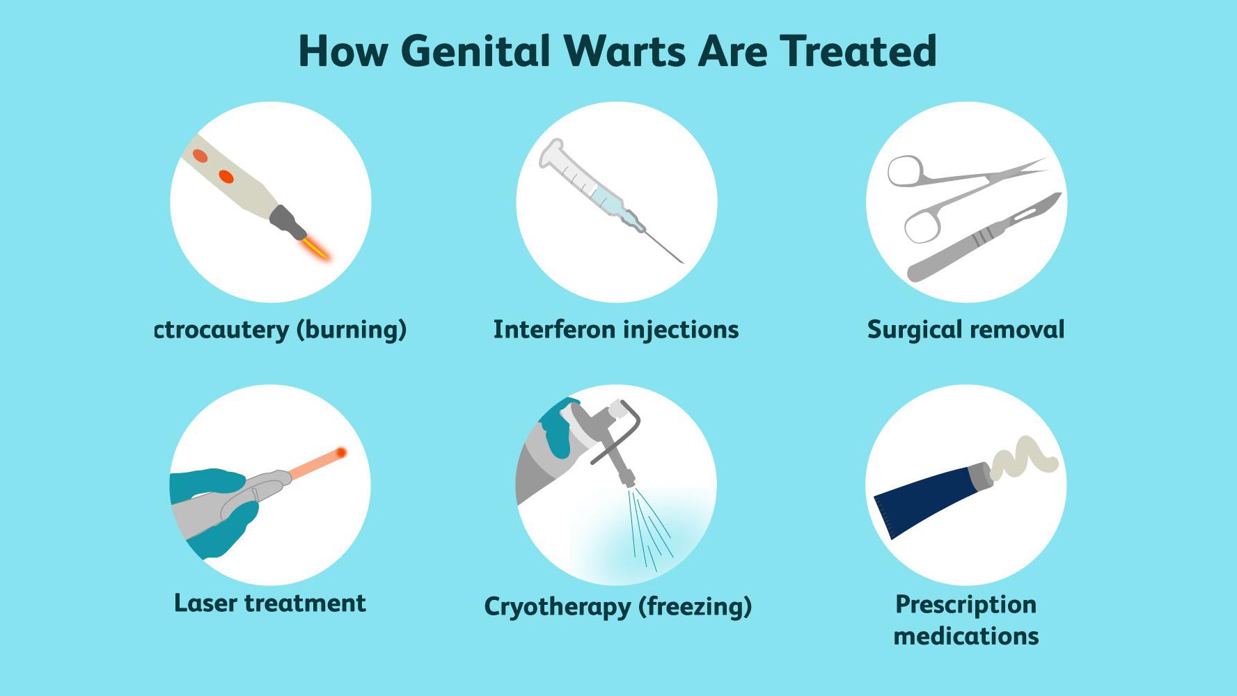 زگیل تناسلی یا Genital Warts چیست؟ علائم و درمان در تهران