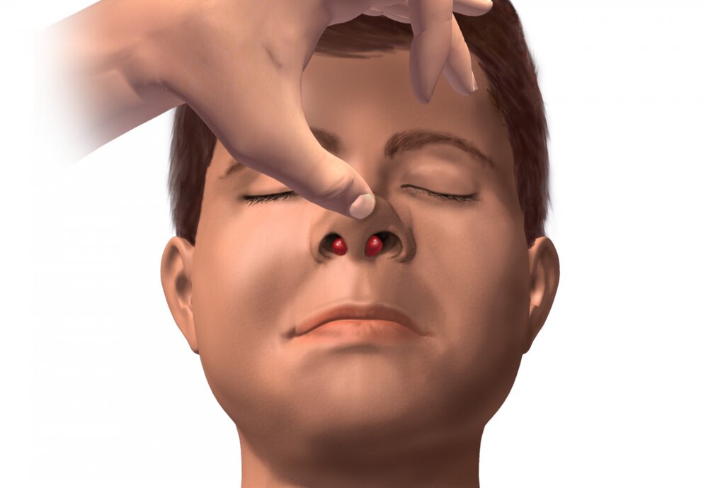 بلافاصله پس از بروز زخم در داخل بینی به پزشک مراجعه کنید