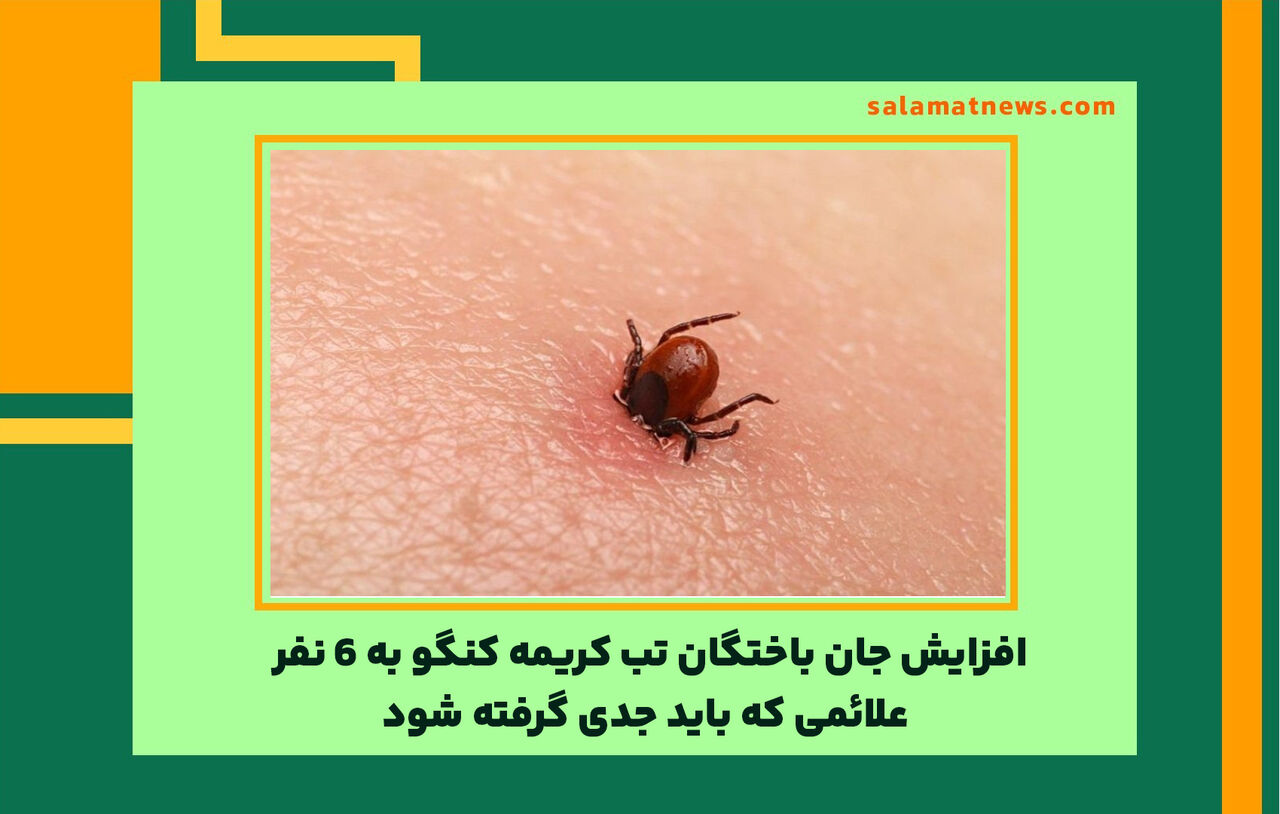 افزایش جان باختگان تب کریمه کنگو به ۶ نفر/ علائمی که باید جدی گرفته شود افزایش جان باختگان تب کریمه کنگو به ۶ نفر/ علائمی که باید جدی گرفته شود