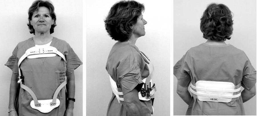 درمان ضایعه و آسیب های نخاعی با استفاده از بریس و ارتز در بهترین مراکز ارتوپدی کشور