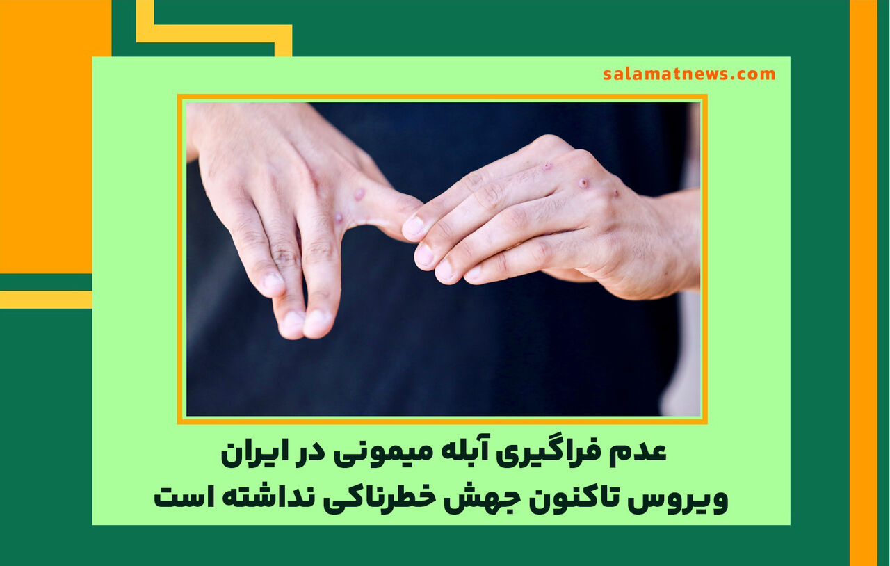 عدم فراگیری آبله میمونی در ایران/ ویروس تاکنون جهش خطرناکی نداشته است عدم فراگیری آبله میمونی در ایران/ ویروس تاکنون جهش خطرناکی نداشته است
