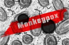 تایید اولین مرگ بر اثر آبله میمونی در آمریکا