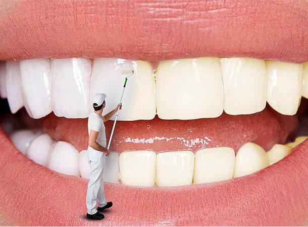 سفید کردن دندان در خانه با بلیچینگ هوم ضرری دارد؟