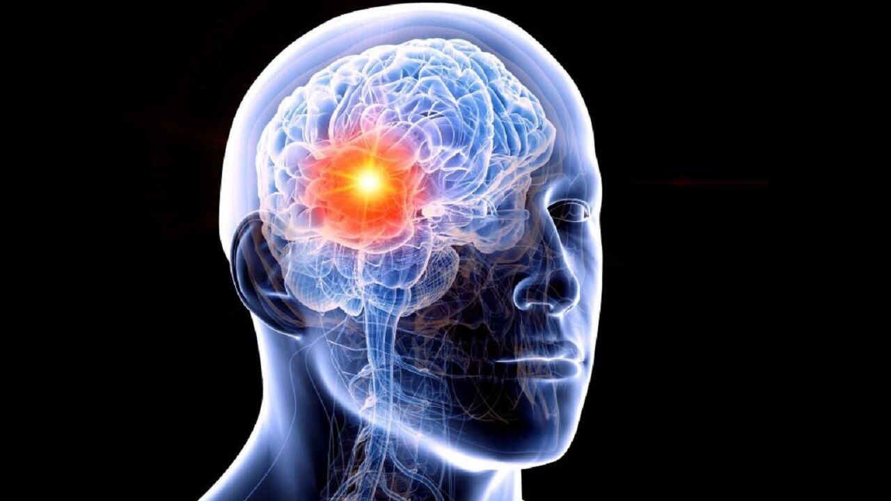 بررسی تومورهای سرطانی با استفاده از فناوری یادگیری عمیق بررسی تومورهای سرطانی با استفاده از فناوری یادگیری عمیق