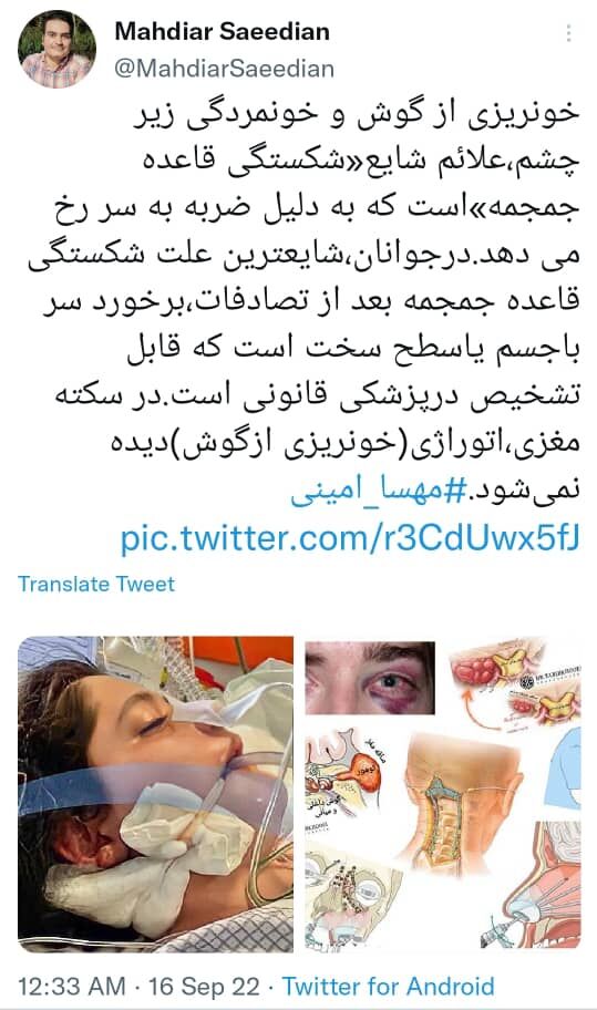 مهسا امینی کد احیا خورد/فوت او رسما اعلام نشده