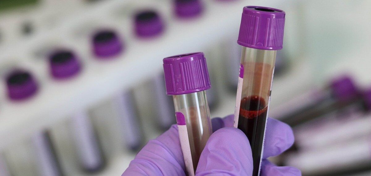 نشانهها و راههای درمانی غلظت خون  نشانهها و راههای درمانی غلظت خون