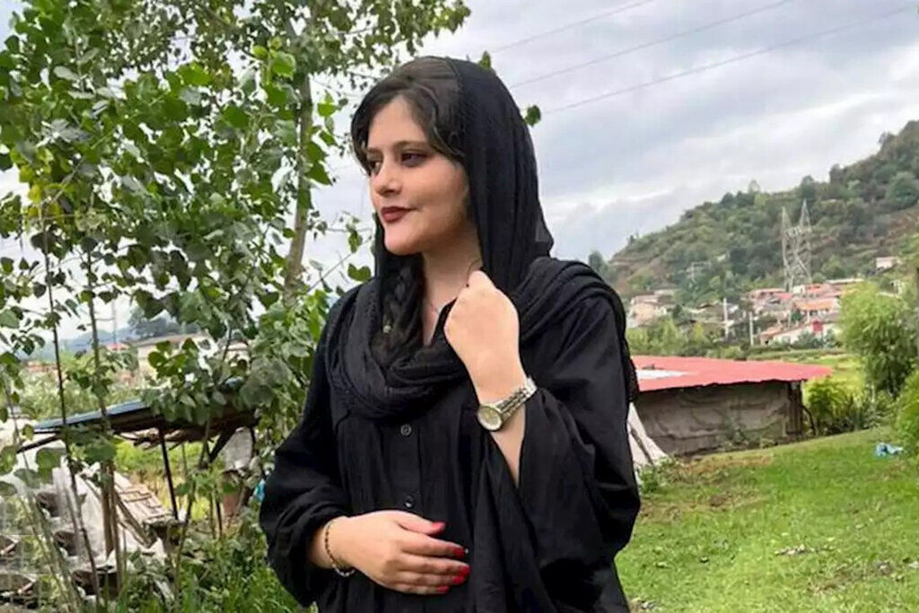 نظر پزشک متخصص رادیولوژی درباره پرونده مهسا امینی نظر پزشک متخصص رادیولوژی درباره پرونده مهسا امینی