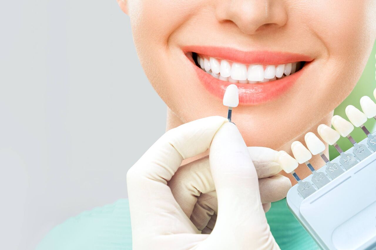 فرق کامپوزیت و لمینت  به زبان ساده فرق کامپوزیت و لمینت  به زبان ساده