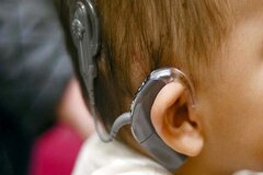 کاشت رایگان حلزون شنوایی کودکان تا ۴ سال/ ۵ استان در صدر شیوع کم‌شنوایی