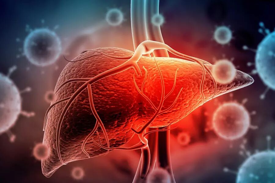 ۷۲۷ بیمار مبتلا به هپاتیت در کشور شناسایی شد ۷۲۷ بیمار مبتلا به هپاتیت در کشور شناسایی شد