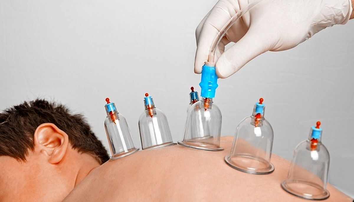 شرایط حجامت در فصل پاییز شرایط حجامت در فصل پاییز