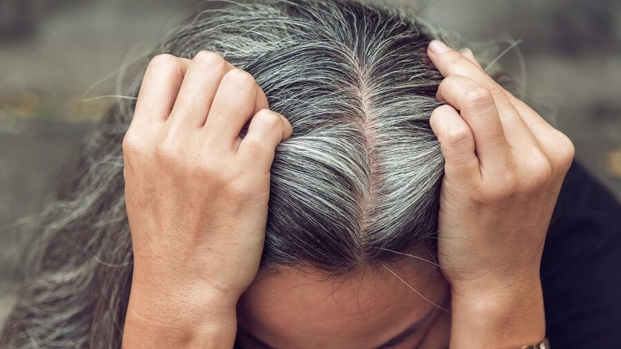 آیا استرس واقعا عامل سفید شدن مو است؟