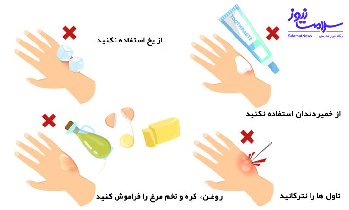 سوختگی پوست