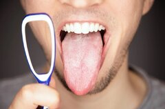 درمان خانگی لایه سفید روی زبان