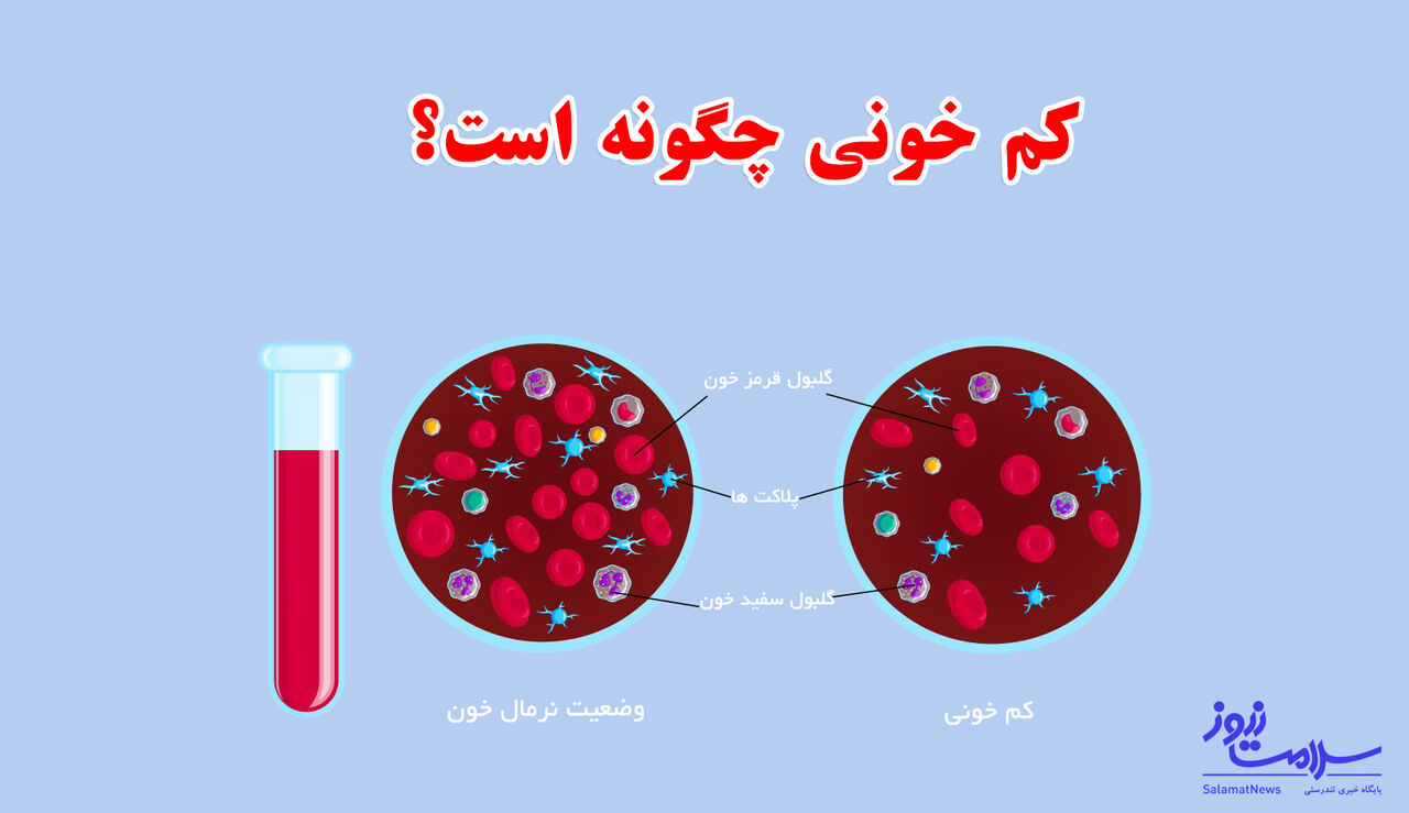 کم خونی