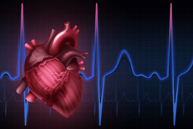 سندرم مرگ ناگهانی آریتمی چیست؟ سندرم مرگ ناگهانی آریتمی چیست؟