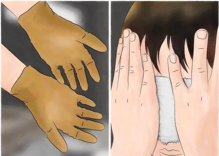 درمان فوری شپش در یک شب