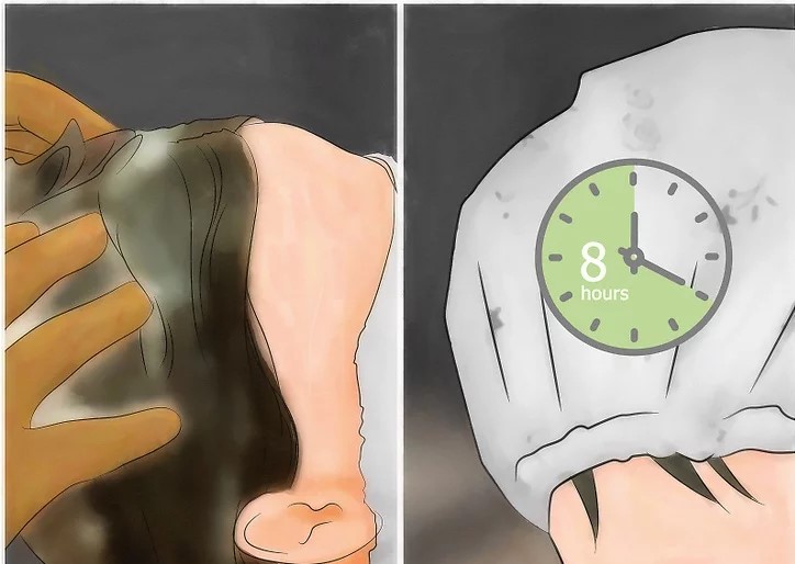 درمان فوری شپش در یک شب