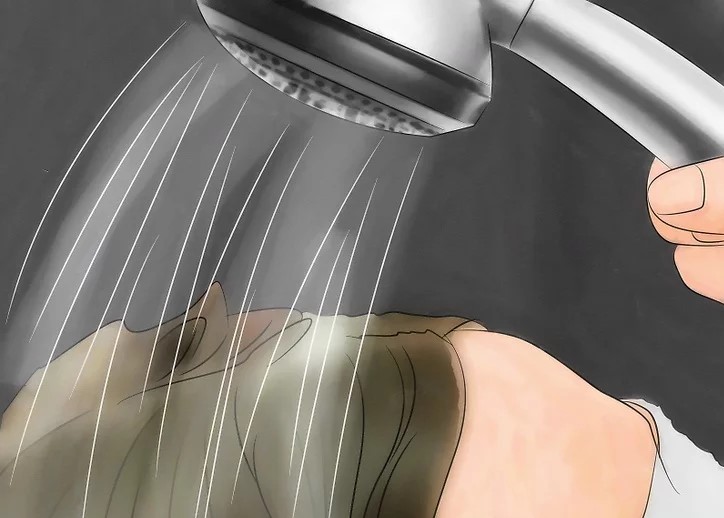 درمان فوری شپش در یک شب