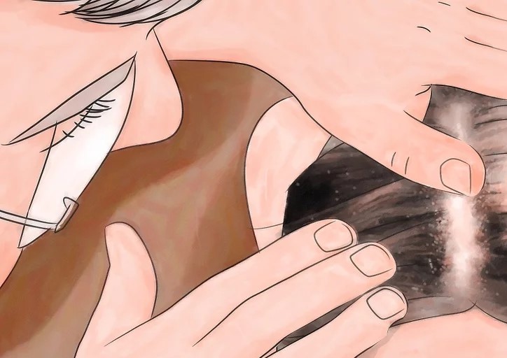 درمان فوری شپش در یک شب