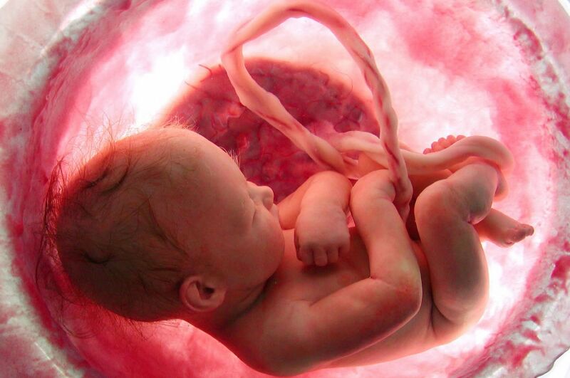پره اکلامپسی در بارداری موجب کُندشدن روند رشد جنین می شود