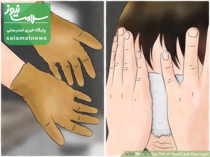 درمان فوری شپش در یک شب