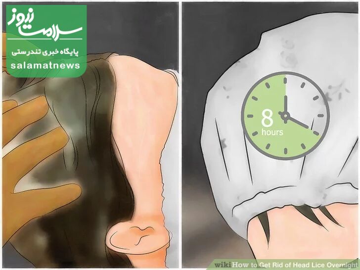 درمان فوری شپش در یک شب