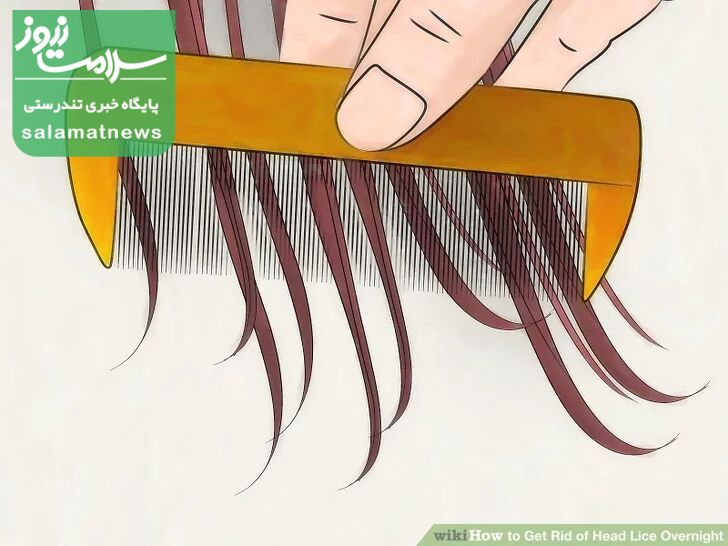 درمان فوری شپش در یک شب