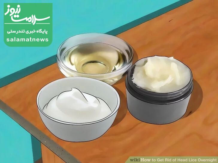 درمان فوری شپش در یک شب