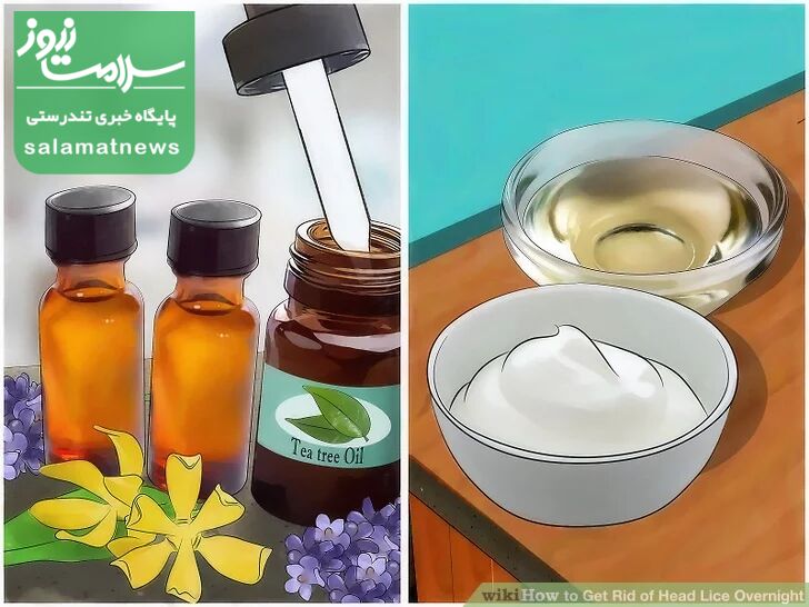 درمان فوری شپش در یک شب