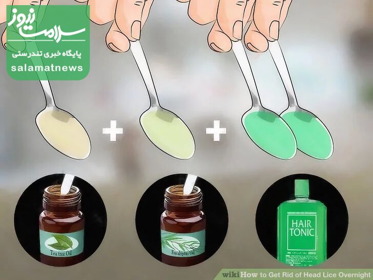 درمان فوری شپش در یک شب