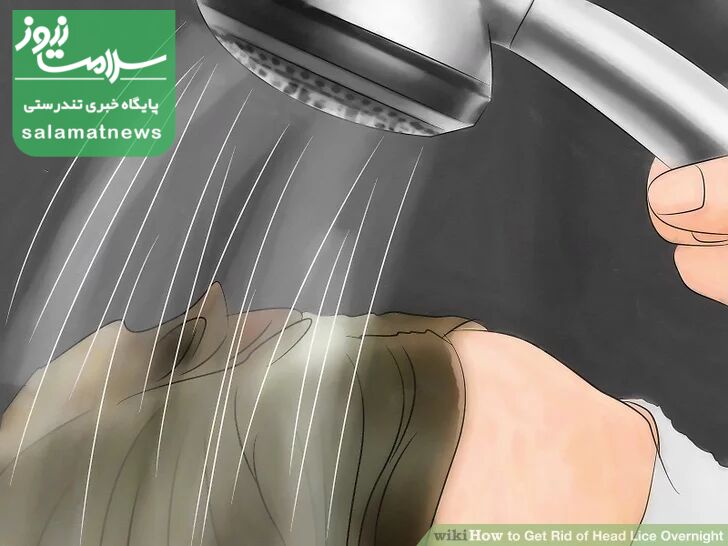 درمان فوری شپش در یک شب