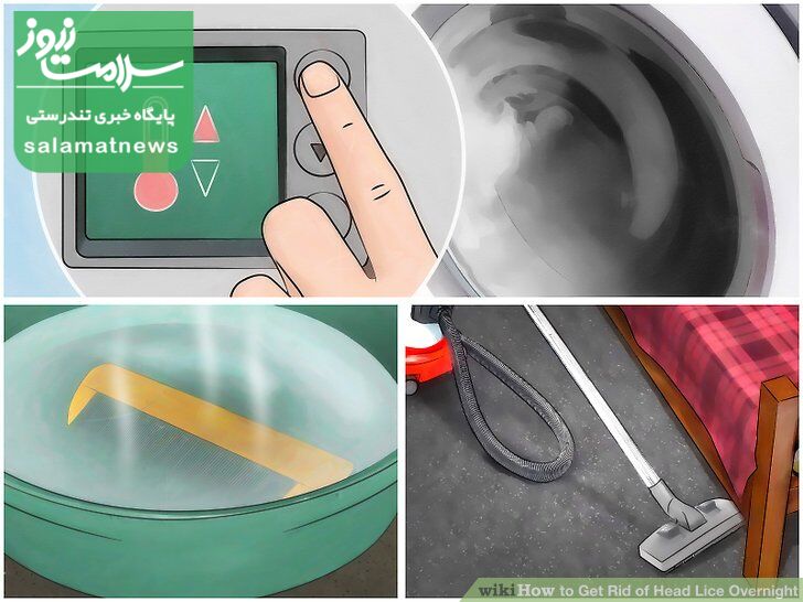 درمان فوری شپش در یک شب