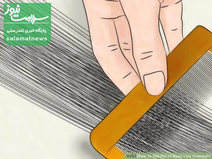 درمان فوری شپش در یک شب