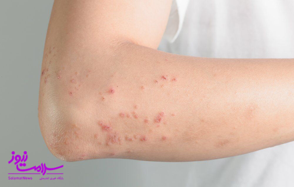 کهیر چیست و چرا کهیر میزنیم؟ کهیر چیست و چرا کهیر میزنیم؟