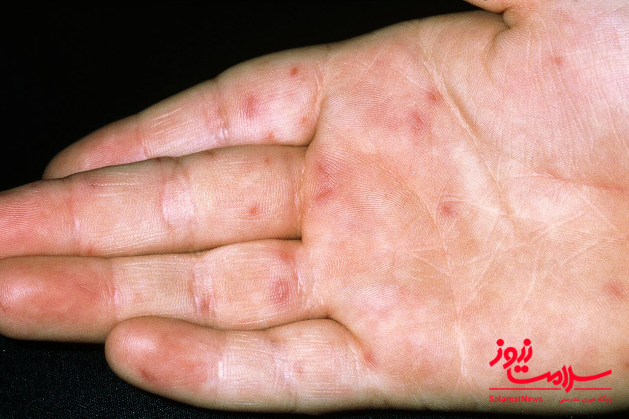 دست پا دهان