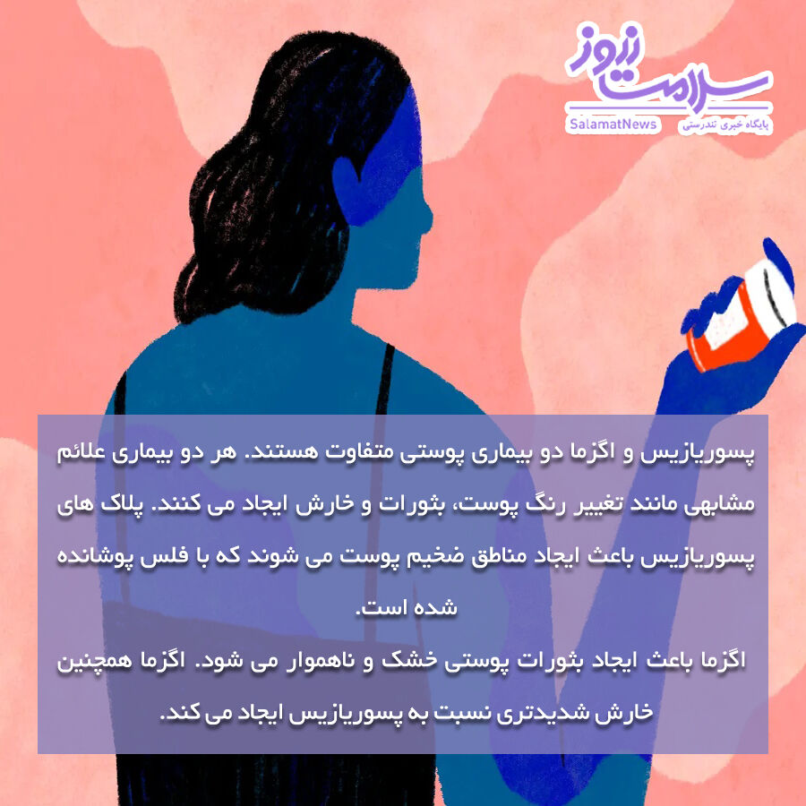 اگزما و پسوریازیس