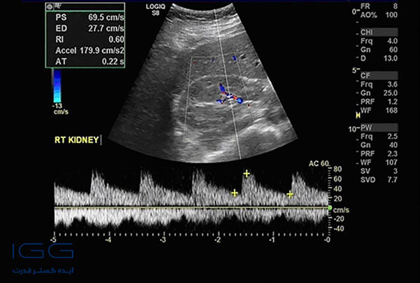 خطرات و مزایای سونوگرافی داپلر برای جنین