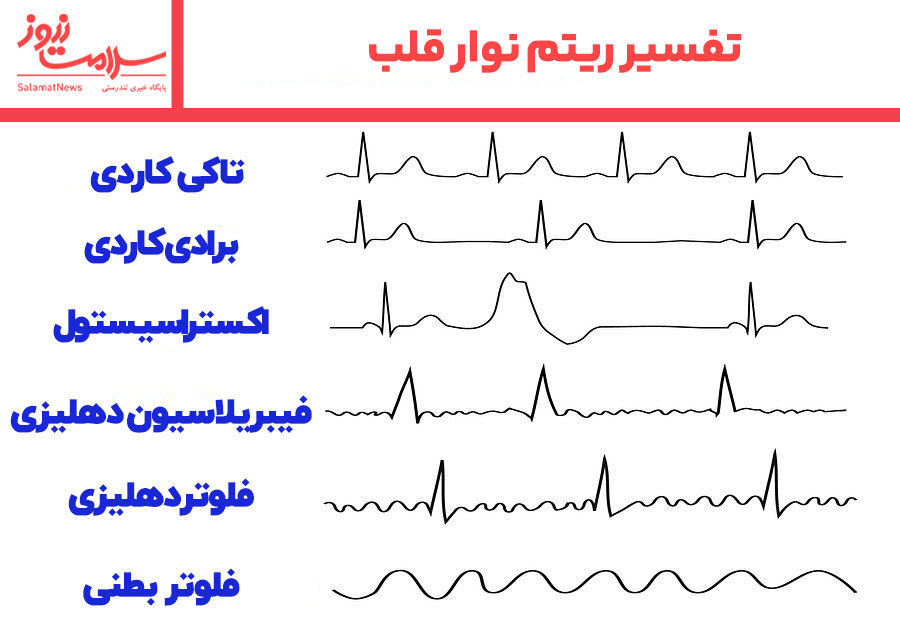 نوار قلب
